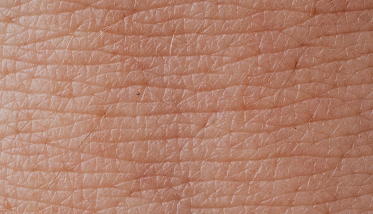 Boala Morgellons, o afectiune bizara a pielii
