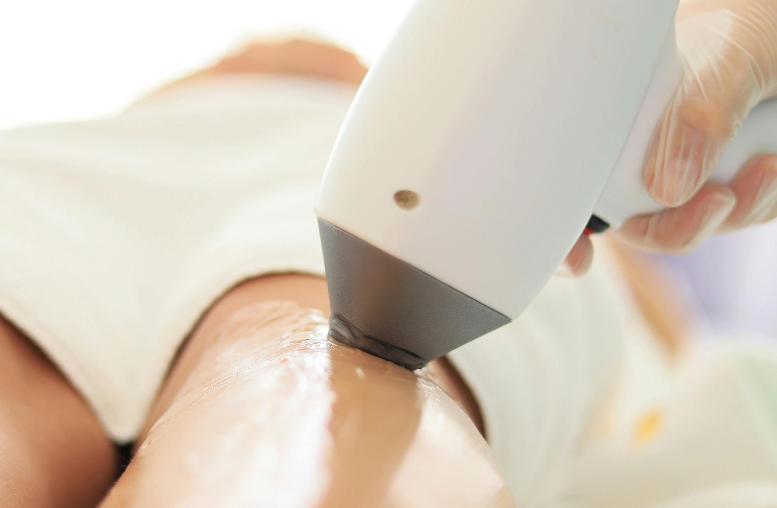 4 cele mai frecvente greseli cand mergi la salon pentru epilare definitiva laser Bucureşti