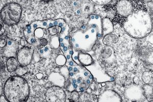 Virusul Nipah si pericolul unei viitoare pandemii asemanatoare pandemiei de COVID-19