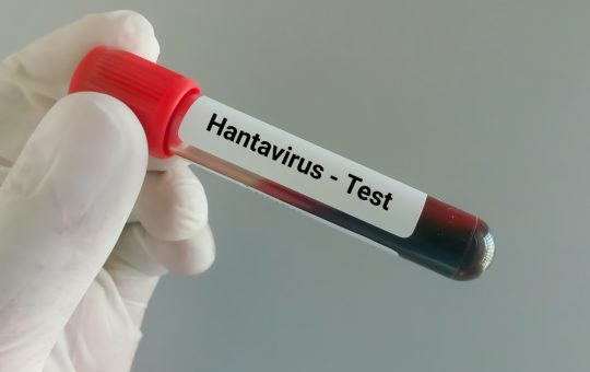 Spania în alertă: Caz suspect de hantavirus în Alicante și implicațiile sale asupra sănătății publice