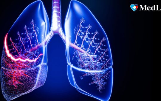 Tusea Persistenta: Semne de Alarmă pentru Bolile Pulmonare Ignorate de Multi