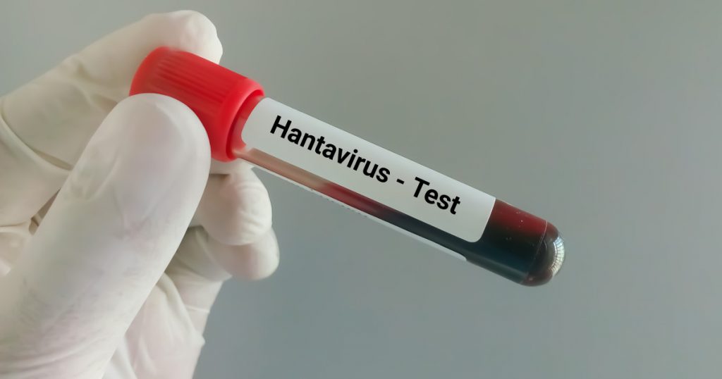 Suspiciune de hantavirus la Arad: O analiză detaliată a riscurilor și implicațiilor epidemiologice