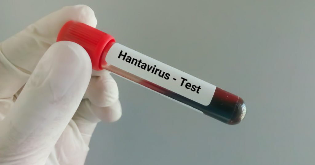 Hantavirus în România: Analiza unui caz de infectare și implicațiile sale pentru sănătatea publică