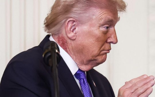 Starea de sănătate a lui Donald Trump: O analiză a controalelor medicale și a implicațiilor politice