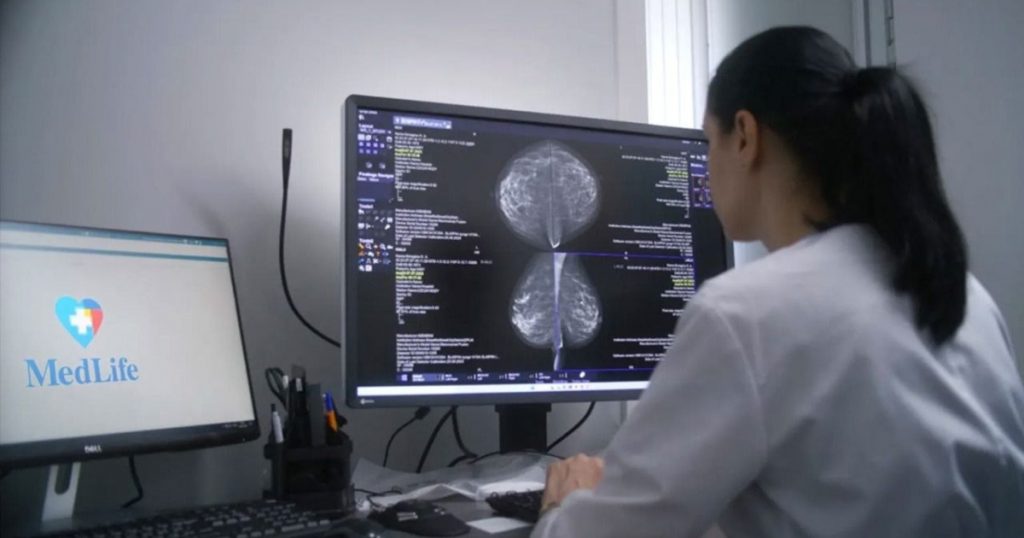 AVC ischemic la 35 de ani: O privire detaliată asupra foramenului ovale patent și a intervenției minim invazive care salvează vieți