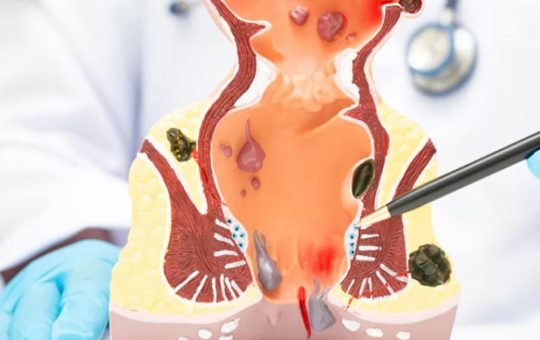 Chirurgia robotică: O nouă speranță în lupta împotriva cancerului rectal metastatic