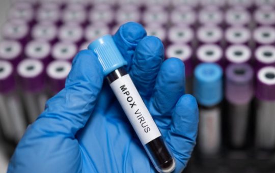 Controversa Fiolelor cu Virus Mpox: De la Cercetare la Acuzații Legale