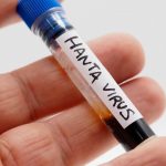 Descoperirea unei noi variante de hantavirus în Argentina: Implicații și contextul epidemiologic