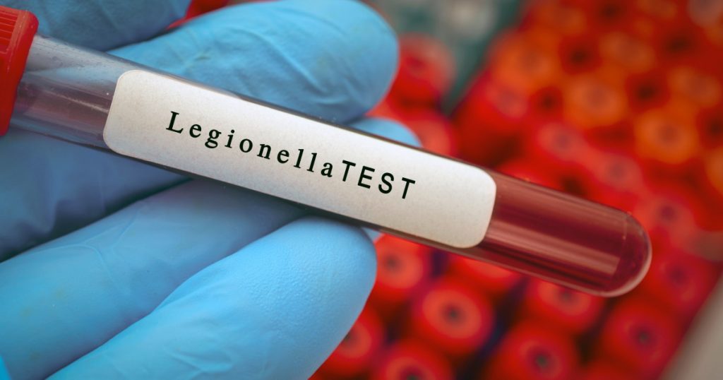 Focar de legioneloză în Basel: O analiză detaliată a impactului și implicațiilor acestei crize de sănătate publică