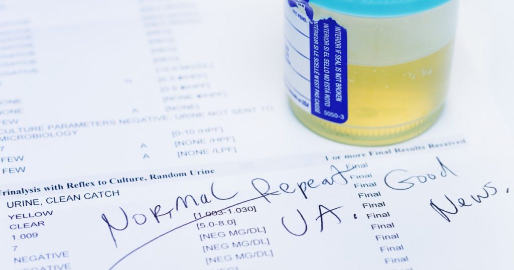 Testul de urină care revoluționează diagnosticul cancerului de vezică urinară: O abordare inovatoare pentru un diagnostic timpuriu