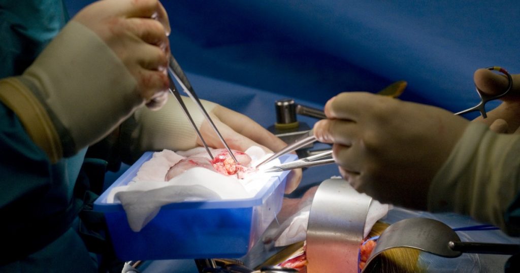 Revoluția Xenotransplantului: Rinichiul de Porc și Viitorul Transplanturilor Renale