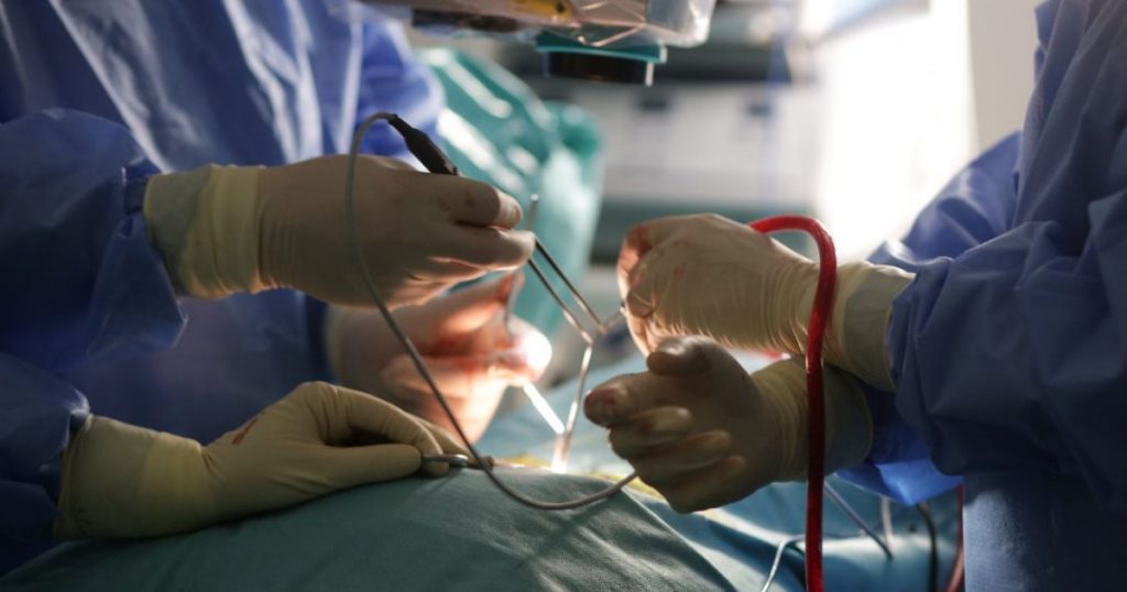 Colecistectomia: O Intervenție Esențială în Litiaza Biliară și Implicațiile Sale pentru Sănătatea Publică