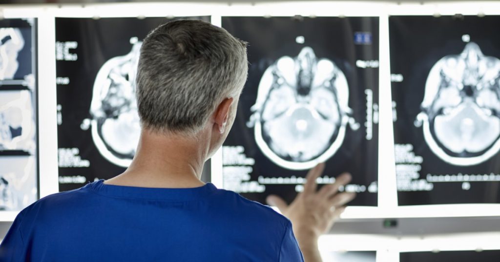 Revoluția în Tratamentul Bolii Alzheimer: O Nouă Era de Speranță și Cercetare