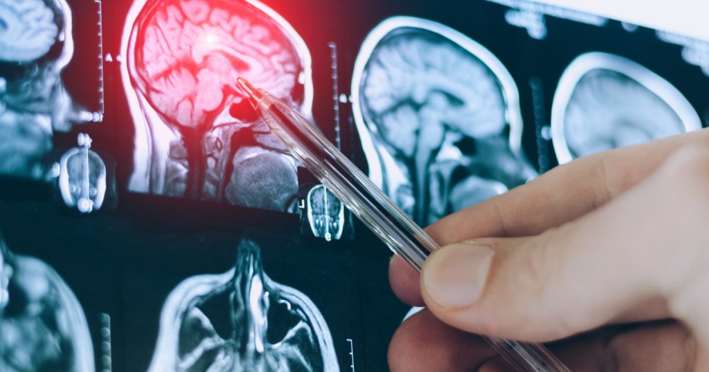 Revoluția în înțelegerea creierului: Descoperiri recente care schimbă paradigmele neuroștiinței